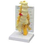 5 Piece Lumbar Vertebrae With Sacrum