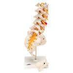Prolapsed Lumbar Section