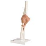 Elbow Joint