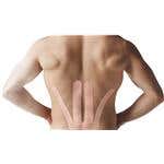 SpiderTech™ Gentle, Low Back