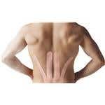 SpiderTech™ Gentle, Low Back