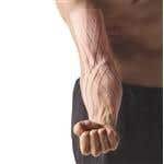 SpiderTech™ Gentle, Large Lymphatic