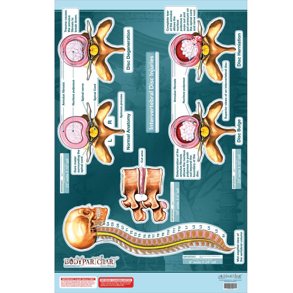 Bodypartchart Intervertebal Disc Injuries