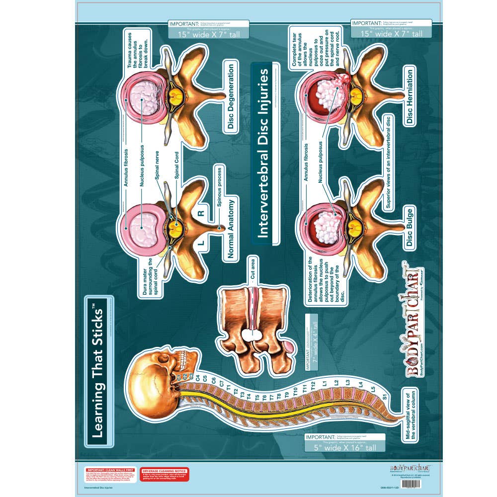 Bodypartchart Intervertebral Disc Injuries