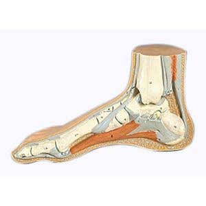 Normal Foot