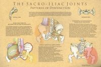 The Sacroiliac Joints: Patterns Of Dysfunction