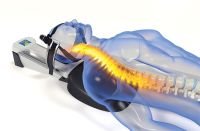 HollyWog ModPod™ Cervical Traction for Neck Pain Relief