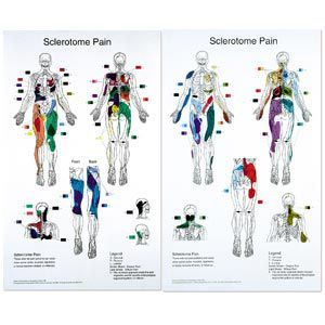 Buy Sclerotome Pain Charts 22