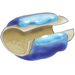 TOREX HOT/COLD COMPRESSION SLEEVES