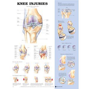Knee Injury Chart 20 X 26 Styrene Plastic