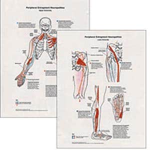 Peripheral Entrapment Neuropathics 2 Chart Set