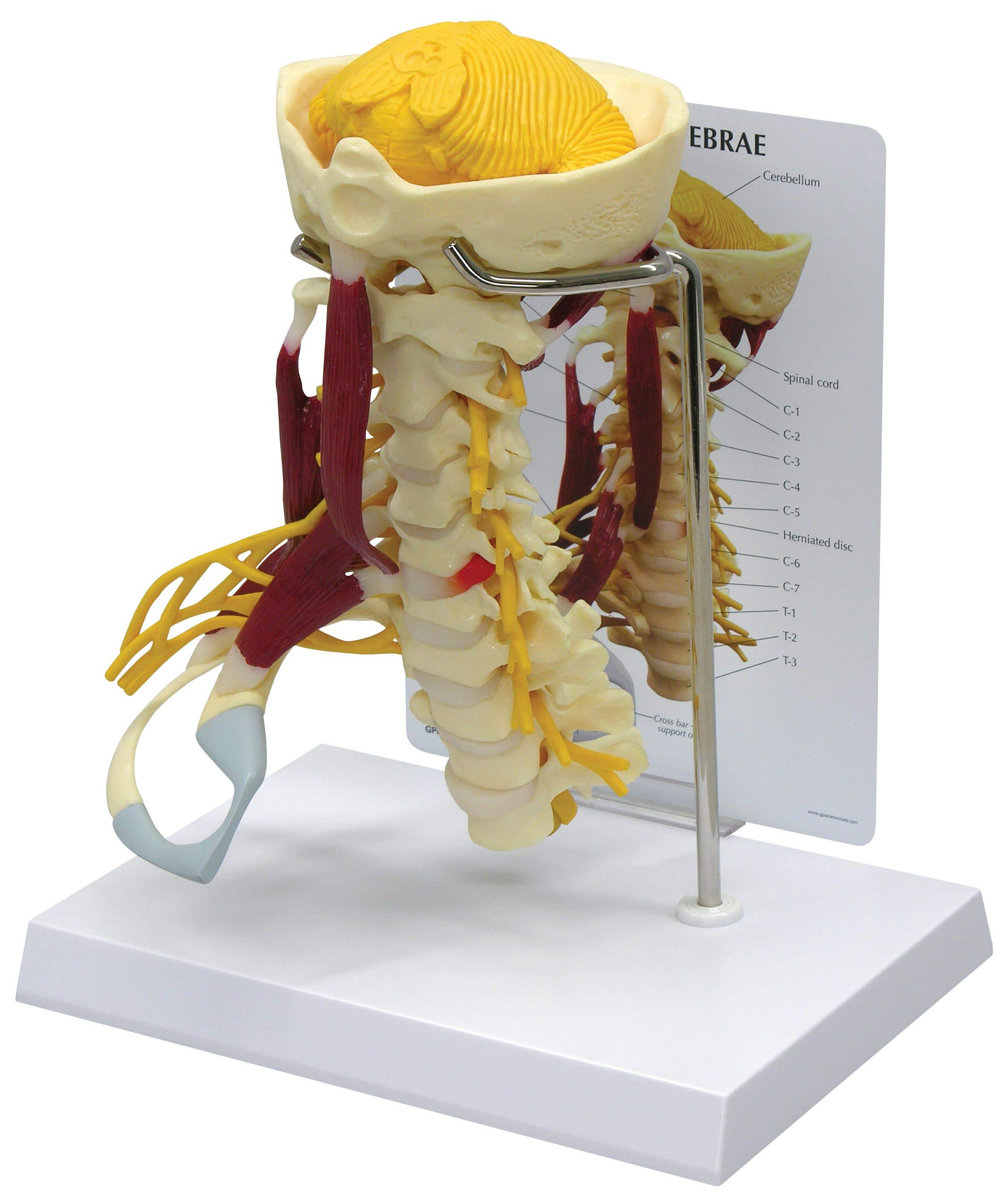 Deluxe Muscled Cervical